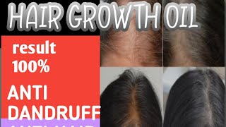 hair growth oil hair growth rosemary oil for hair growth hair growth tips wild growth hair oil [upl. by Aimek]