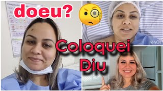 COLOQUEI DIU MIRENA NO HOSPITAL COM ANESTESIA COMO FOI A EXPERIÊNCIA [upl. by Penrod282]