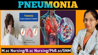 Pneumonia  Respiratory Tract Infection  Symptoms  Pathophysiology  Treatment  Pediatric Nursing [upl. by Albur]