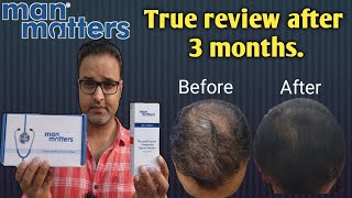 Man matters hair regrowth treatment 3 months honest review manmatters hair [upl. by Aeli628]