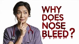 Why Does My Nose Bleed Causes and Solutions Explained [upl. by Marsden]