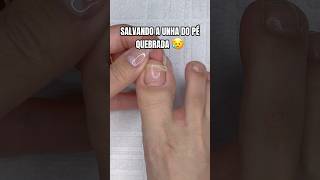 Salvando a unha do pé quebrada com polygel 🫣 unhasdospés pedicure pes [upl. by Down19]