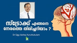 സ്ട്രോക്ക് എങ്ങനെ നേരത്തെ തിരിച്ചറിയാം  How to Prevent Stroke  Arogyam [upl. by Eisac]