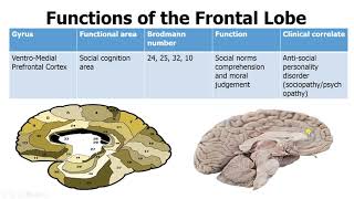 Introduction Neuroanatomy Video Lab  Brain Dissections [upl. by Hyacinth]