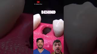 dental Digest amazing short video food satisfying mukbang experiment funny tiny [upl. by Aleuname]