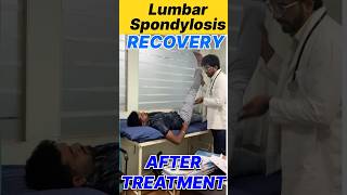 Lumbar Spondylosis Recovery After Treatment yt ytshorts ytviral doctor fitness fit 100 ad [upl. by Ytrebil57]