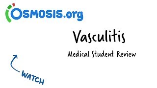 Vasculitis  Clinical Presentation [upl. by Burtis]