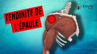 COMPRENDRE LA TENDINITE DE LÉPAULE Explications professionelles [upl. by Ecienal]