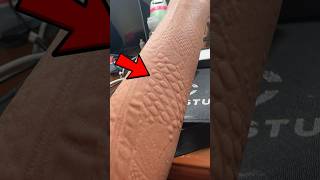 Weird Skin Condition 😨 [upl. by Adnalram]