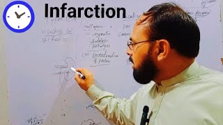 infarction  infarction pathology in urduinfarction general pathology  myocardial infarction❤️‍🔥 [upl. by Llevra]