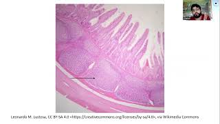 Peyers Patches and Spleen Immunology Lecture 72 [upl. by Akemehc]