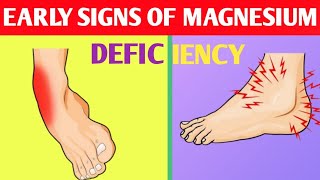 The early signs of magnesium deficiency magnesiumdeficiency lowmagnesium [upl. by Nomyaw]