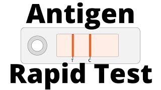 INDICAID COVID19 Rapid Antigen Test  Demo Video [upl. by Billen420]