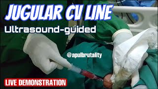 Jugular CV line ultrasound guided  central venous catheter CVC  vena dalam [upl. by Brandt]