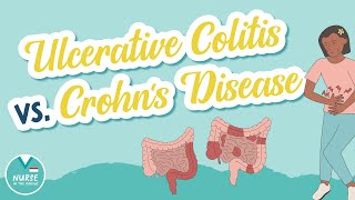 Ulcerative Colitis vs Crohns Disease  Know the Difference  Med Surg Help for Nursing School [upl. by Akiem]