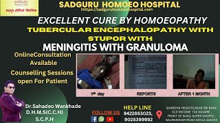 TUBERCULAR ENCEPHALOPATHY STUPOR MENINGITIS GRANULOMA  HYDRONEPHROSIS CURE Dr Sahadeo Wankhade [upl. by Alahsal]