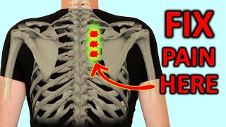 quotRhomboid Painquot How To Fix Shoulder Blade Pain Quickly [upl. by Lil]