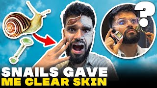 Testing Viral Skin Care Products For Clear Skin ft Korean Skincare  BeYourBest Skincare San Kalra [upl. by Tillford]