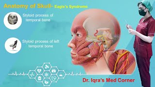 Eagle Syndrome Elongation of styloid process of temporal bone [upl. by Yelreveb]