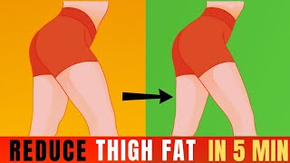 5 Min Inner Thigh Workout  How to Slim Thigh At Home [upl. by Rhyner]