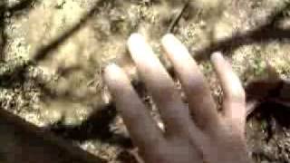 YouTube clonus hand tremor [upl. by Anidam]