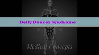 Belly Dancer Syndrome [upl. by Jessy]