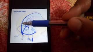 DURAL VENOUS SINUSES simplest explanation part 2 [upl. by Giorgia493]