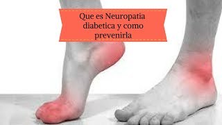 Que es neuropatia diabetica y como prevenirla [upl. by Rialc]