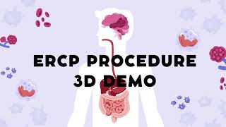 ERCP procedure 3d DEMO ERCP MedicalProcedure Gastroenterology [upl. by Richella]