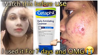 Cetaphil Daily Exfoliating cleanser review in hindi  cetaphil moisturising cream  cetaphil cleanse [upl. by Demmahum]