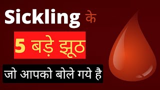 sickling के 5 बड़े झूठ जो आपको बोले गये हैSickle cell Anemia [upl. by Kira]