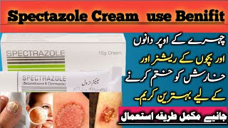 Spectazole cream uses in urdu  Clotrimazole and betamethasone [upl. by Girand206]