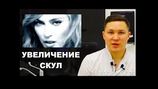 УВЕЛИЧЕНИЕ СКУЛ  Dr SItanovich [upl. by Dietsche]