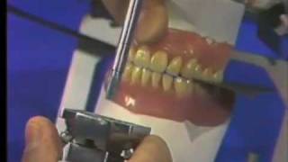 Delivery of Complete Denture  Part 2 [upl. by Brynne]