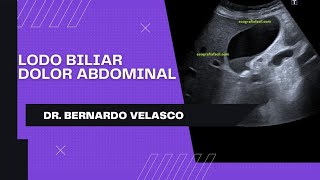 LODO BILIAR LA PARED DE MI VESÍCULA SE INFLAMO Dolor Abdominal y náuseas 🤢 [upl. by Demetre]