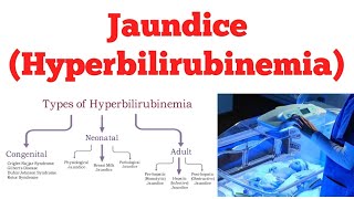 Hyperbilirubinemia  Jaundice  Biochemistry [upl. by Heger571]