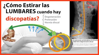 ¿Cómo hacer EJERCICIO de Estiramiento Lumbar en DISCOPATÍA 👉Degeneración Protrusión o Hernia discal [upl. by Coppock836]