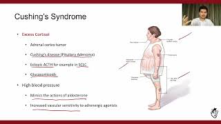 Secondary Hypertension Part 23 Endocrine Causes [upl. by Maleki924]