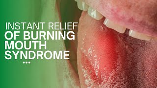 Instant relief from burning mouth syndrome [upl. by Emilie]