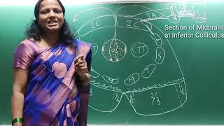 SECTION OF MIDBRAIN  INFERIOR COLLICULUS [upl. by Foote]