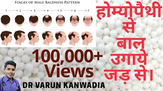 5 Homeopathic Medicines for HairLoss गंजेपन या बालों का झड़ना [upl. by Kawasaki]