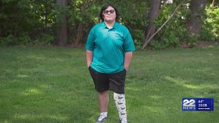 Massachusetts teen with prosthetic leg to compete in Shriners Children’s Open in Vegas [upl. by Shantee]