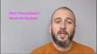 FUE Hair Transplant Recovery  Week 10 [upl. by Swanhilda962]