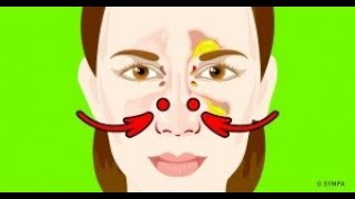 5 Façons efficaces de déboucher ton nez rapidement [upl. by Johppa]