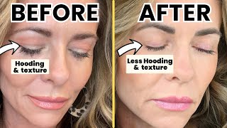 DIY HOODED EYES Fix  TCA Peel Treatment at Home Guide [upl. by Beauchamp75]