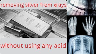 REMOVING SILVER FROM XRAYS WITHOUT USING ANY ACID [upl. by Nair362]