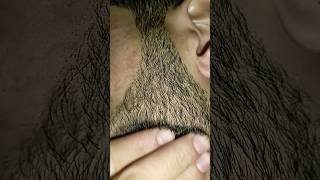 hair dresser viralshort hairremoval hairproblem [upl. by Scutt]