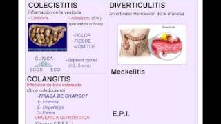 AA INFLAMATORIOavi [upl. by Elspet849]