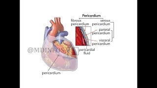 Pericardial effusion  Types of fluid [upl. by Aikimat]