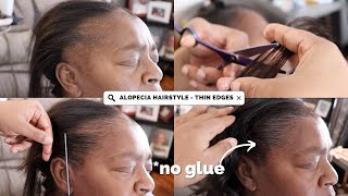 THIN EDGES TRANSFORMATION  TRACTION ALOPECIA HAIRSTYLE [upl. by Lemra]